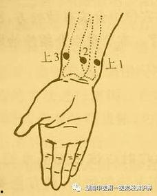 腕踝针疗法视频,轻松掌握的神奇针灸技巧揭秘